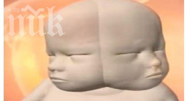 Невероятно! Родители очакват бебе с две лица