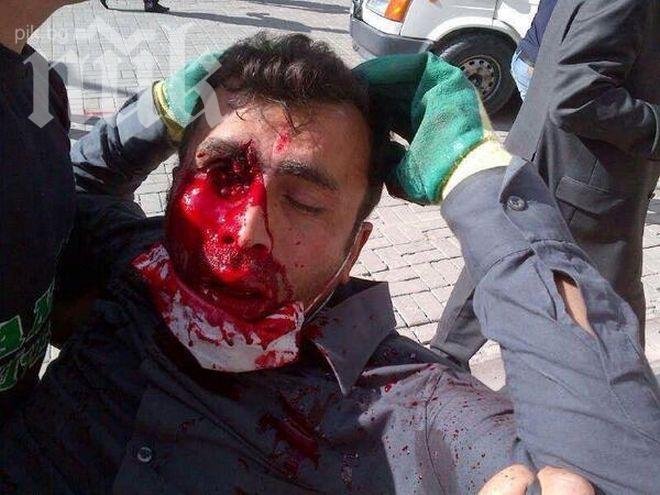 Един човек загина, а 77 бяха ранени при протест в Папуа Нова Гвинея