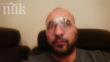 Мишо Шамара легна под ножа