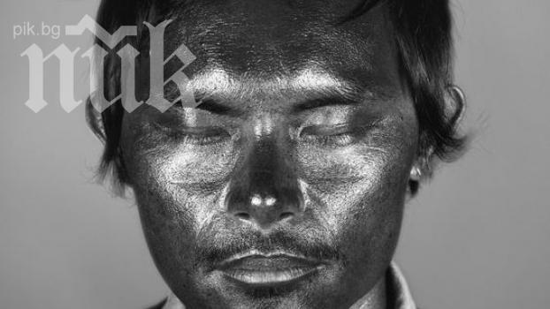 Ужас! Вижте какво се случва с кожата ни, ако я излагаме твърде много на слънце (снимки)