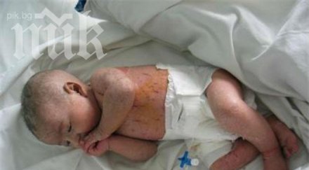 милион бебета умират раждането