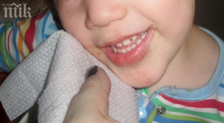 бум алергии заради мокрите кърпички