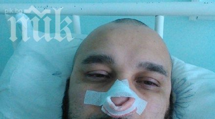 мишо шамара разпада претърпя втора операция две седмици снимка