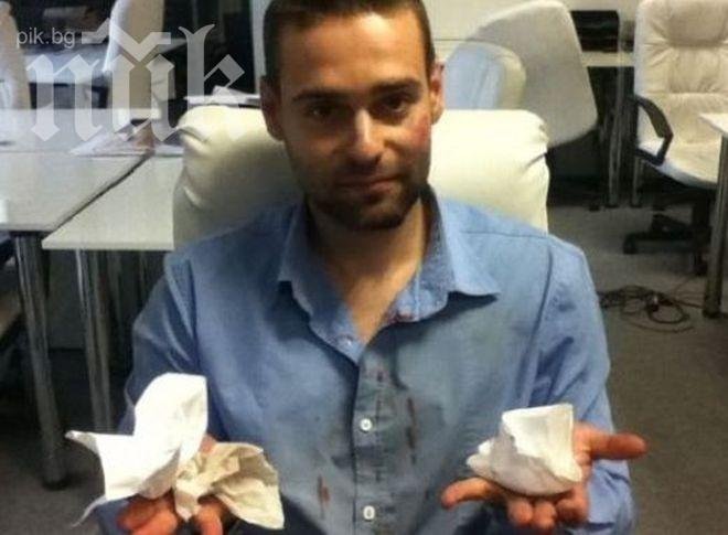 Фенове на Левски разбиха главата на спортен журналист