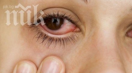 странен вирус плъзна софия атакува очите прилича алергия шарки върлуват страната