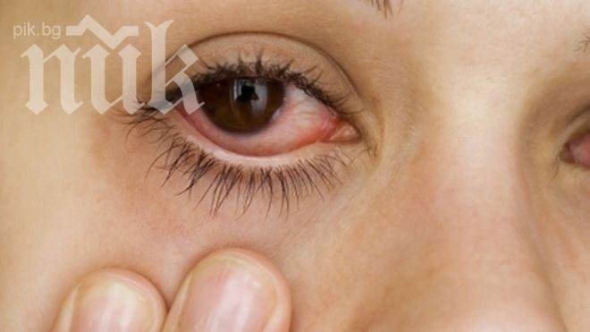 Странен вирус плъзна из София, атакува очите, прилича на алергия. Шарки върлуват в страната