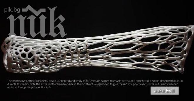 3D гипсова отливка ще лекува с помощта на ултразвук (ВИДЕО)