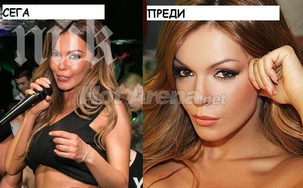 Галена се обезобрази! Цъфна с нови скули (Който ги е правил, ръцете си е оставил)