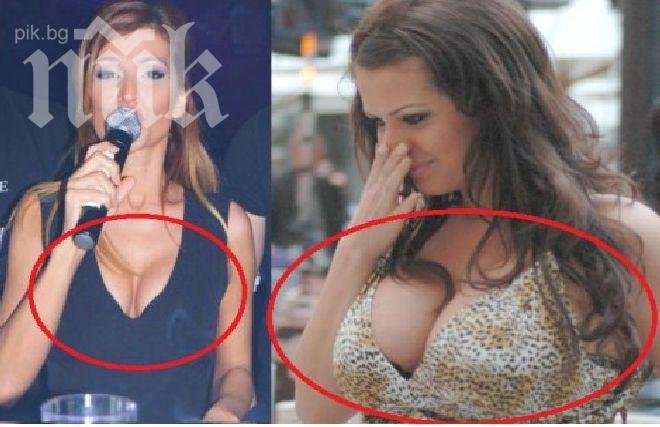 Преслава показа намаления си бюст! Вижте каква е разликата (снимка)