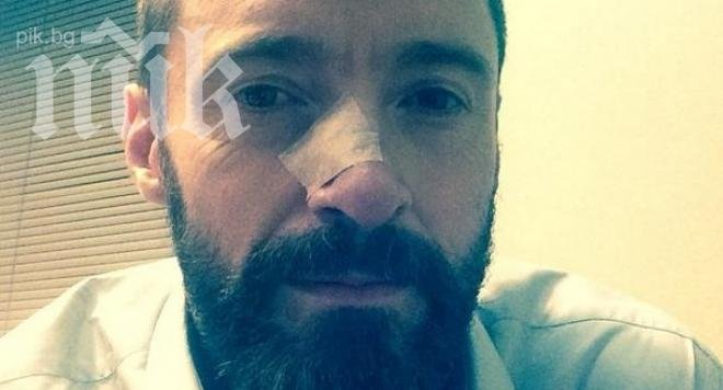 Хю Джакман се оперира втори път от рак