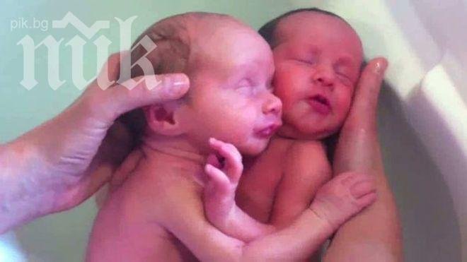 57-годишна роди близнаци в Бургас