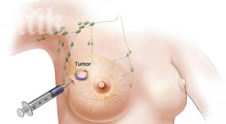 невероятни съвета предпазите рак учени черният бъз соята убиват туморите