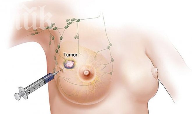 Невероятни 11 съвета как да се предпазите от рак! Учени: Черният бъз и соята убиват туморите!