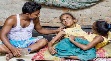 сиамски близначки влюбиха един мъж вижте уникалната история