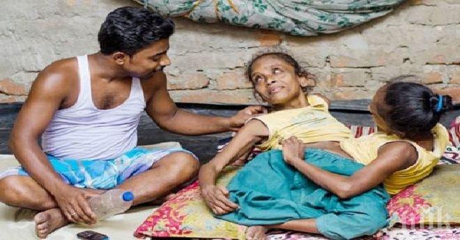 Сиамски близначки се влюбиха в един мъж. Вижте уникалната им история!