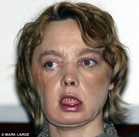 Жената с лице на заем се показа