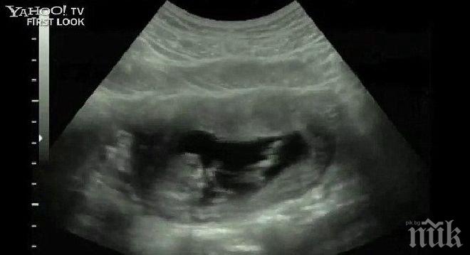 Шок! Британска ученичка с 4 аборта преди да навърши 16
