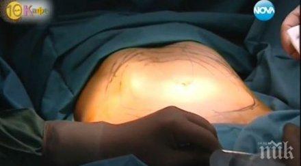 гала показа липосукция ефир снимка