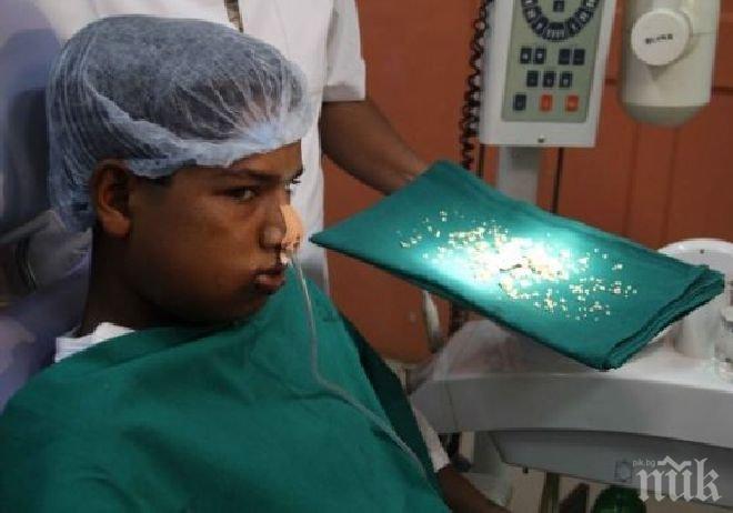 Извадиха 232 зъба от устата на индийско момче