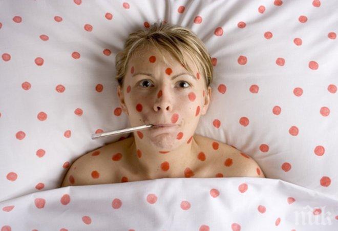 Варицела върлува във Варненско