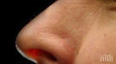 зъб порасна носа арабин