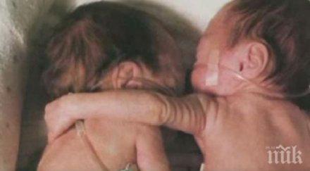 уникално прегръдката промени медицината снимка видео