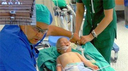 бебе родено без ноздра правят отвор носа уникален метод