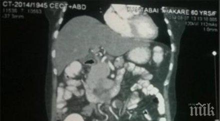 жена ембрион утробата