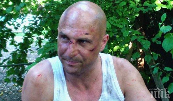 Светльо Витков с шокираща снимка във Фейсбук! Пребит ли е музикантът?