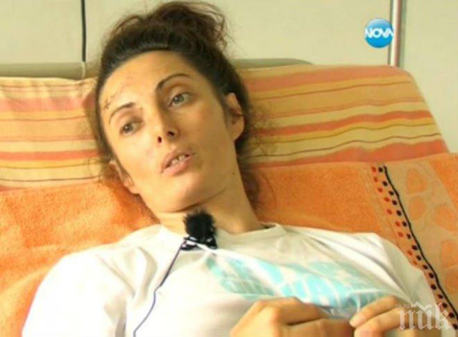 Изписаха Мария, която падна с асансьора от деветия етаж