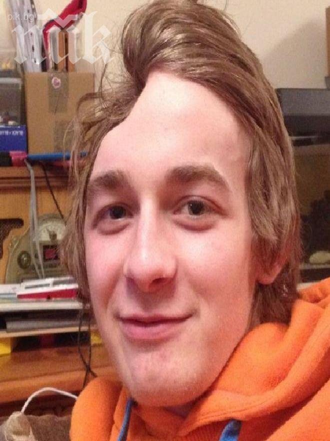 Младеж оцеля след удар с чук, живее с половин глава 