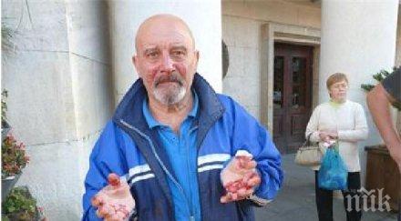 нападнаха активист реформаторския блок бургас разбиха носа