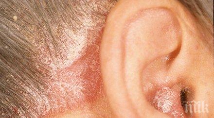 световният ден хората псориазис