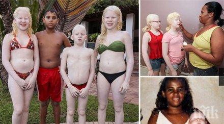 едно милион негърка роди три албиносчета снимки видео