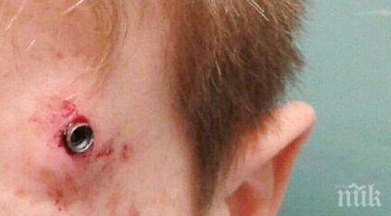 кошмар простреляха главата годишен футболист снимка