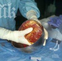 Стотици британски пациенти са получили отхвърлени бъбреци