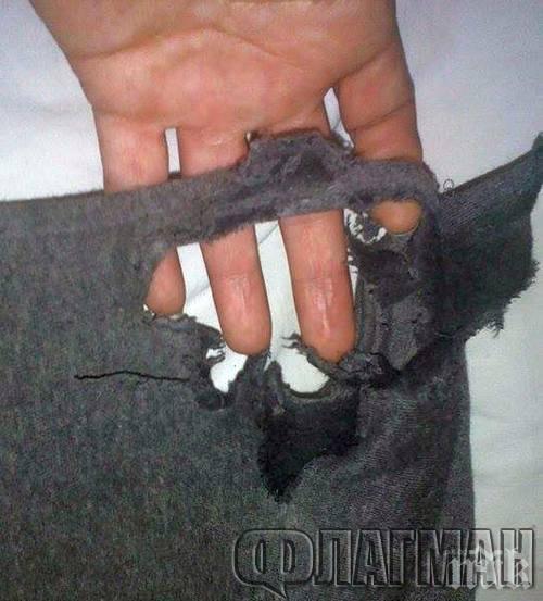 Опасна игра в Бургас! Младежи взривяват дрехите си с пиратки (снимки)