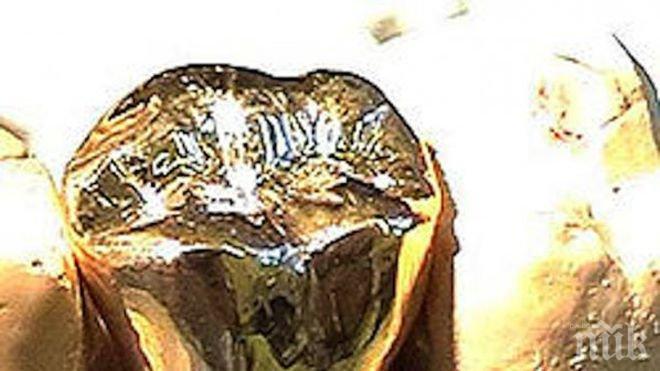 Хора продават златни коронки да си купят лекарства