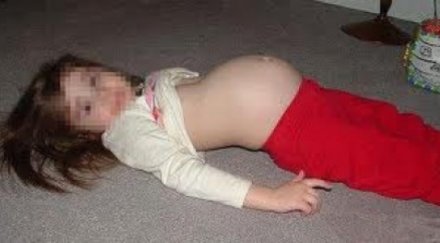 годишна туркиня забременя