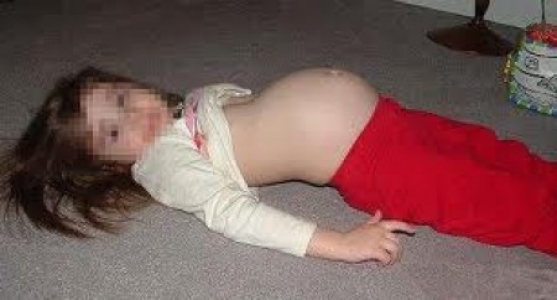 10-годишна туркиня забременя