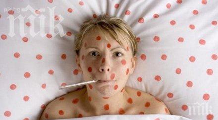 болните варицела пазарджик увеличили