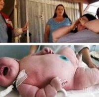 Шок! 280-килограмова жена роди 18-килограмово бебе гигант (16+)