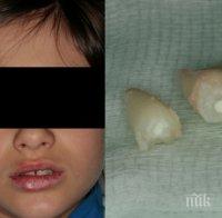 Бой във варненско училище! Правят сложна операция на устата на зверски пребит петокласник (документ+снимка)