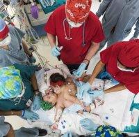 Разделиха сиамски близначки с 26-часова операция