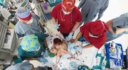 разделиха сиамски близначки часова операция