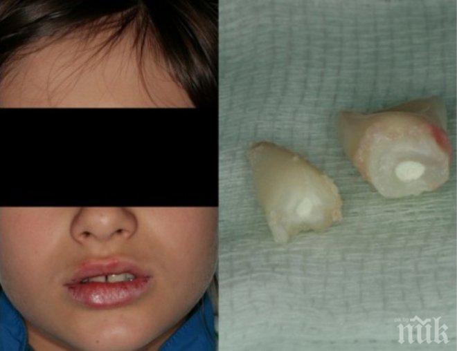 Бой във варненско училище! Правят сложна операция на устата на зверски пребит петокласник (документ+снимка)