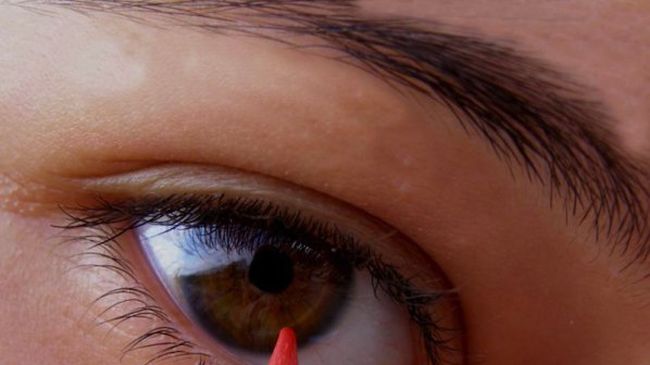 Студът отключи конюнктивита