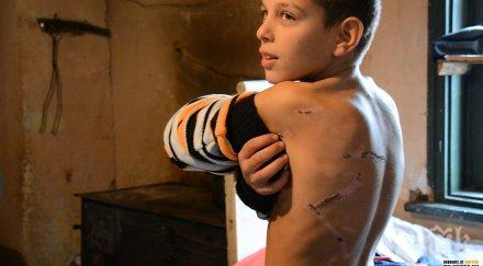 бхк дете институция било насилвано