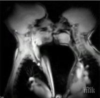 Секс между скелети, така изглежда половият акт, заснет с ядрено-магнитен резонанс (видео)