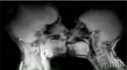 секс скелети изглежда половият акт заснет ядрено магнитен резонанс видео